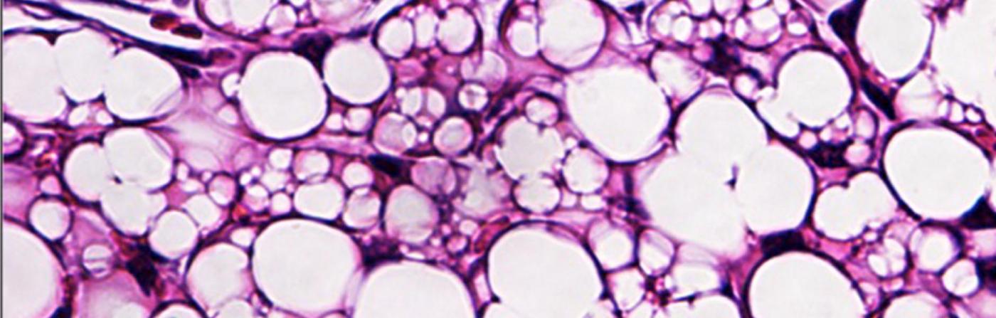 Murine beige fat cells 